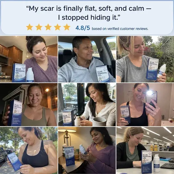 Flatter, Smoother, Calmer Scars in as Little as 3 Days