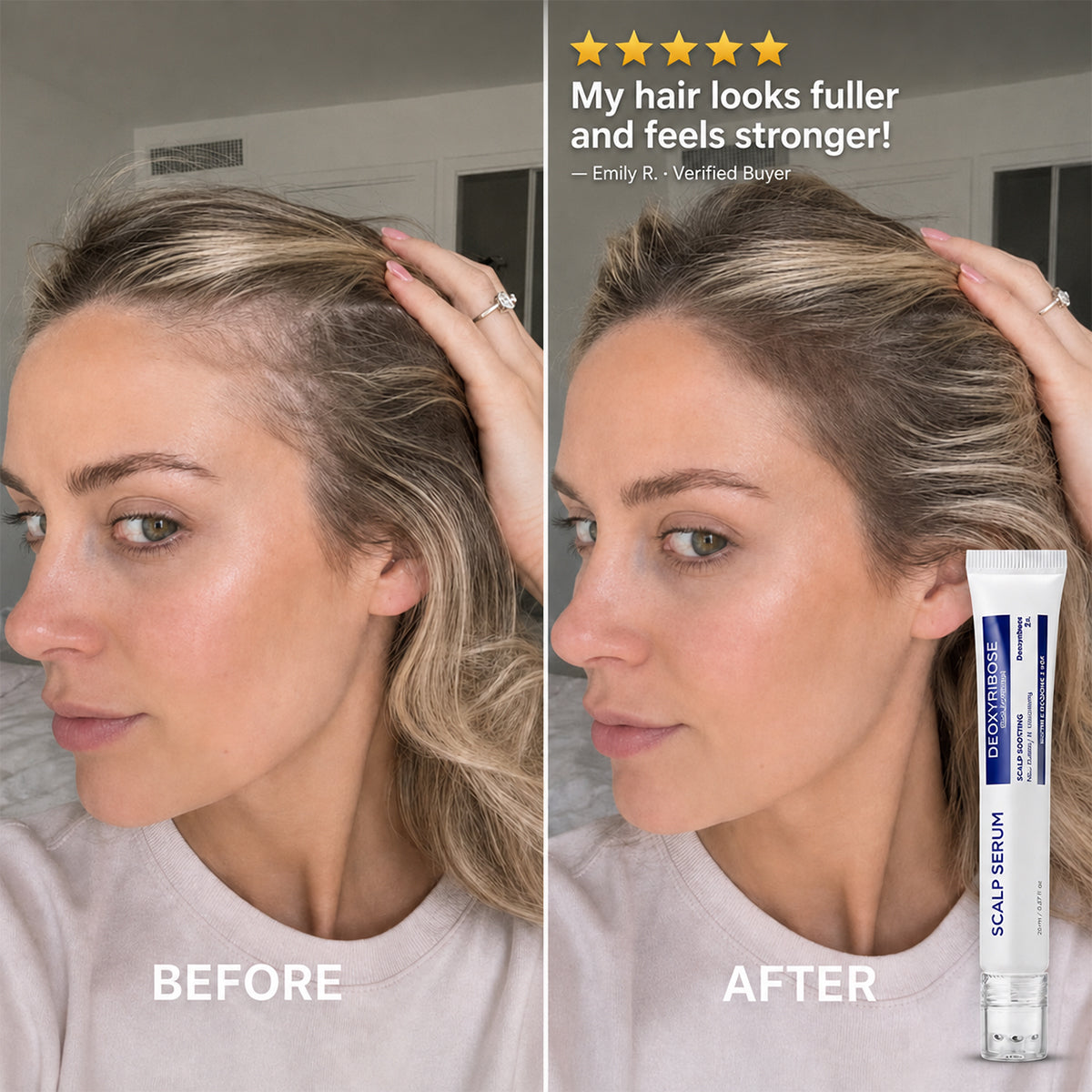 Deoxyribose Scalp Serum
