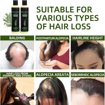 Vibeourplus Rosemary Shampoo✨
