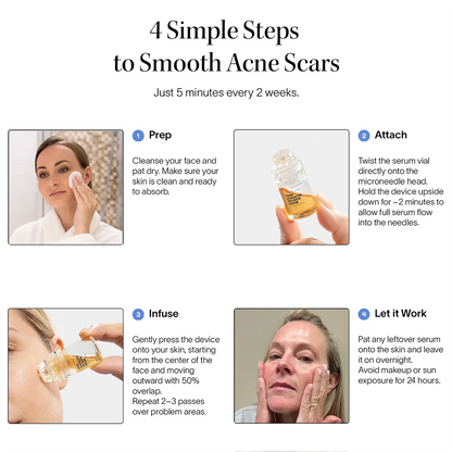 PDRN Advanced Infusion Treatment