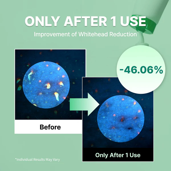 Centella Deep Pore Cleansing Foam