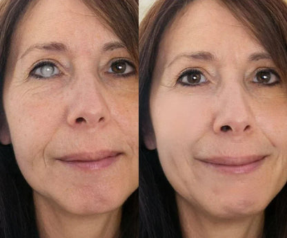 Vibeourplus Nano Eye Roller Serum