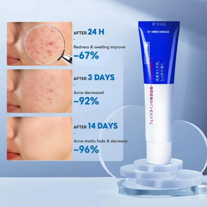 Acne Treatment-Pimples Removal Cream Pair