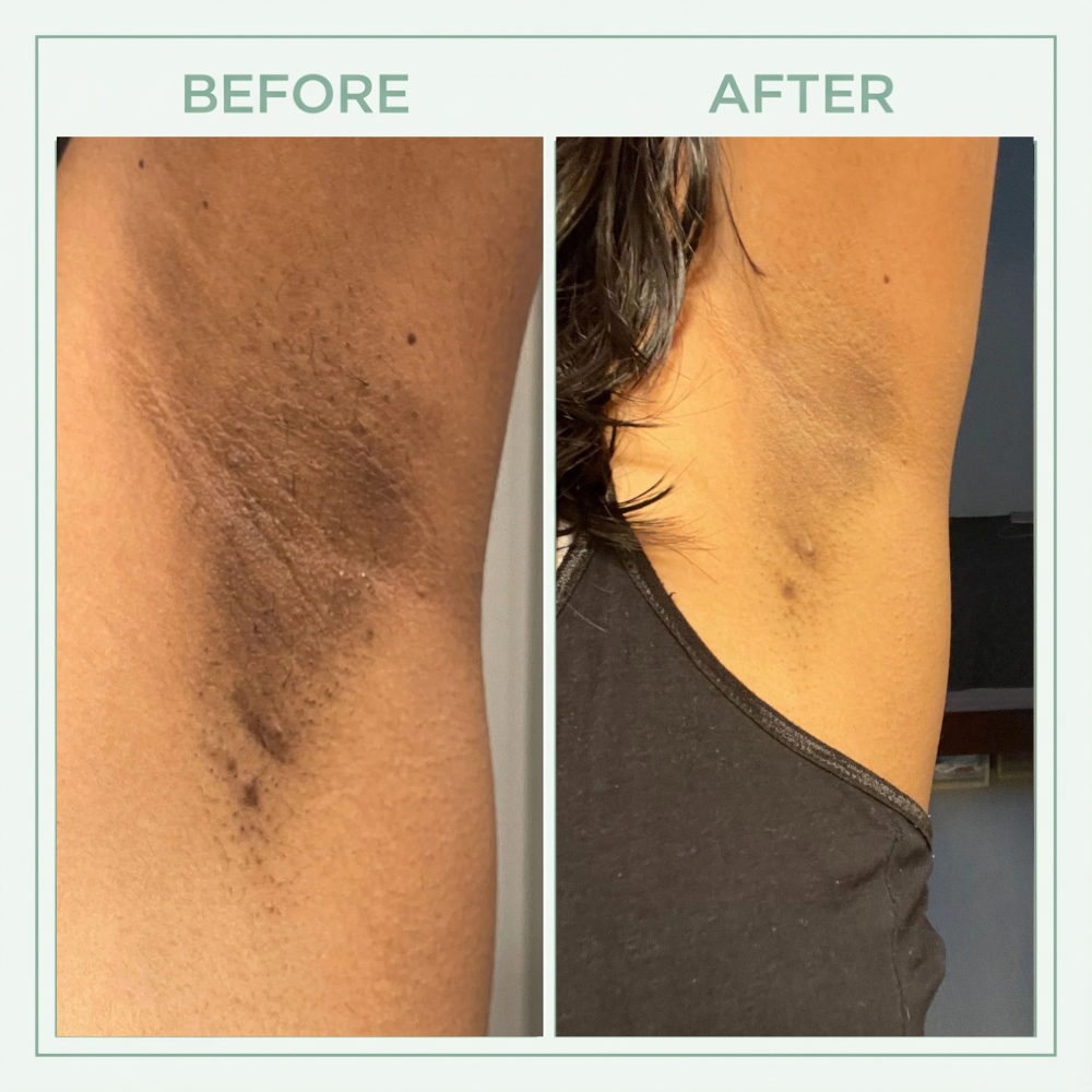 Vibeourplus™ Bright Peel Spray