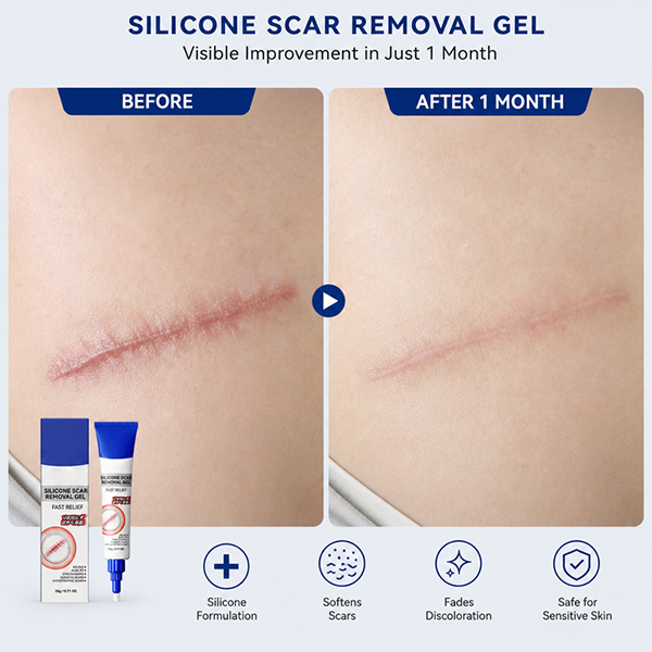🔥HOT SALE 49% OFF🔥  Advanced Silicone Scar & Wrinkle Smoothing Gel