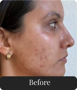 Before treatment