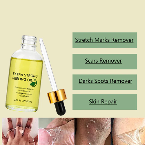 Vibeourplus Yellow Peeling Oil: Gentle Body Hyperpigmentation Treatment | Fade Dark Spots in 2 Weeks
