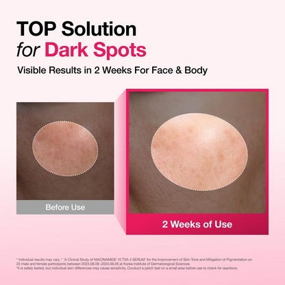 Niacinamide 10 TXA 4 Serum for Brightening and Dark Spots