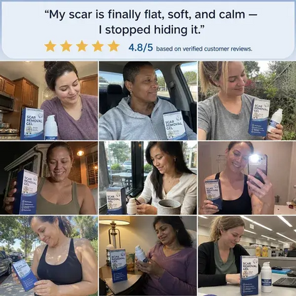 Flatter, Smoother, Calmer Scars in as Little as 3 Days