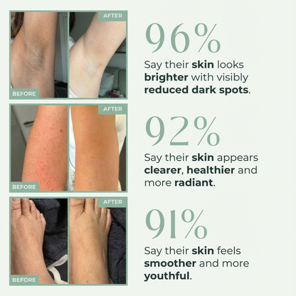 Vibeourplus™ Bright Peel Spray