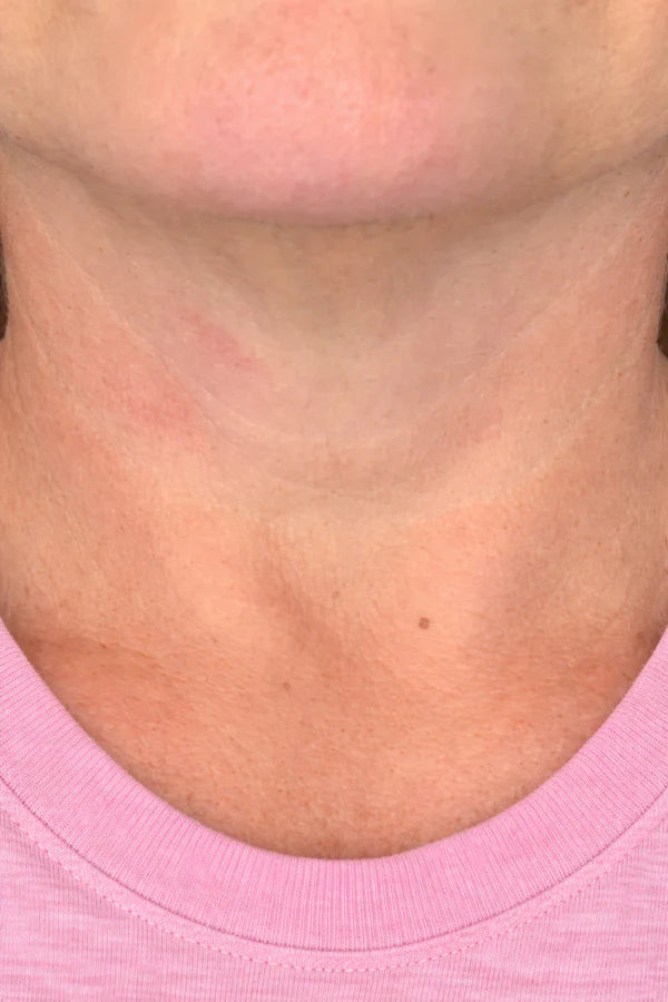 4daacf60cc53e9fefc.webp
