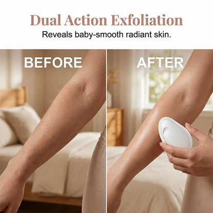 🥳2026 HOT SALE🥳💞50K+ SOLD!🔥Ergonomic Hair Removal Tool with Protective Cover