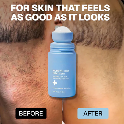 Vibeourplus: Smoothing Solution For Ingrown Hairs