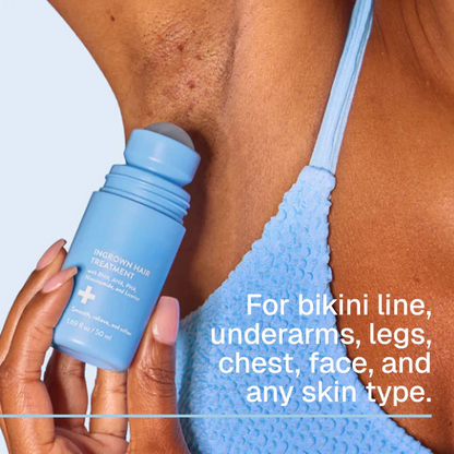 Vibeourplus: Smoothing Solution For Ingrown Hairs