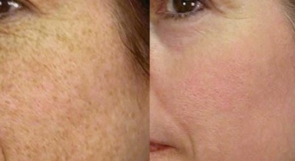 Brightening_Booster_Glow_Mask_-_FloreLisse07_23570170-6502-4f5a-96fc-a963306ec2d8.png