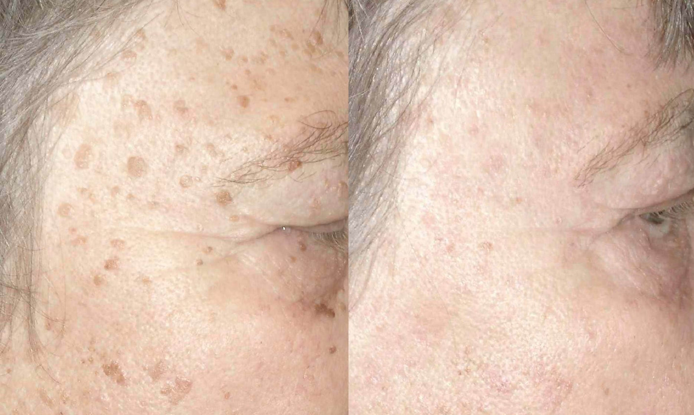 Brightening_Booster_for_Pigmentation_Spots_002.jpg