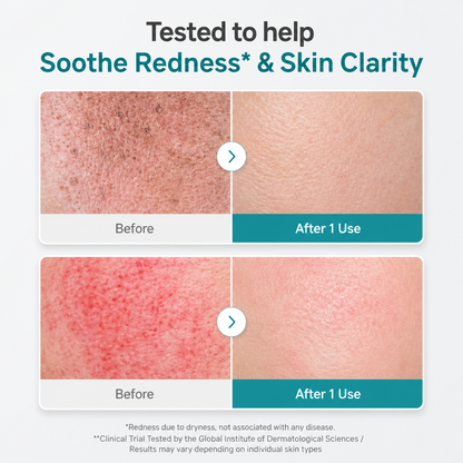 Azelaic Acid Capsule Foam Cleanser