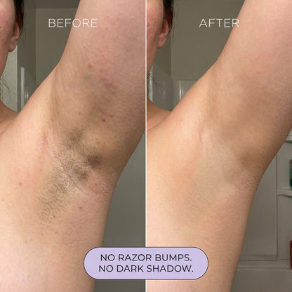 Vibeourplus Hair Removal Mousse