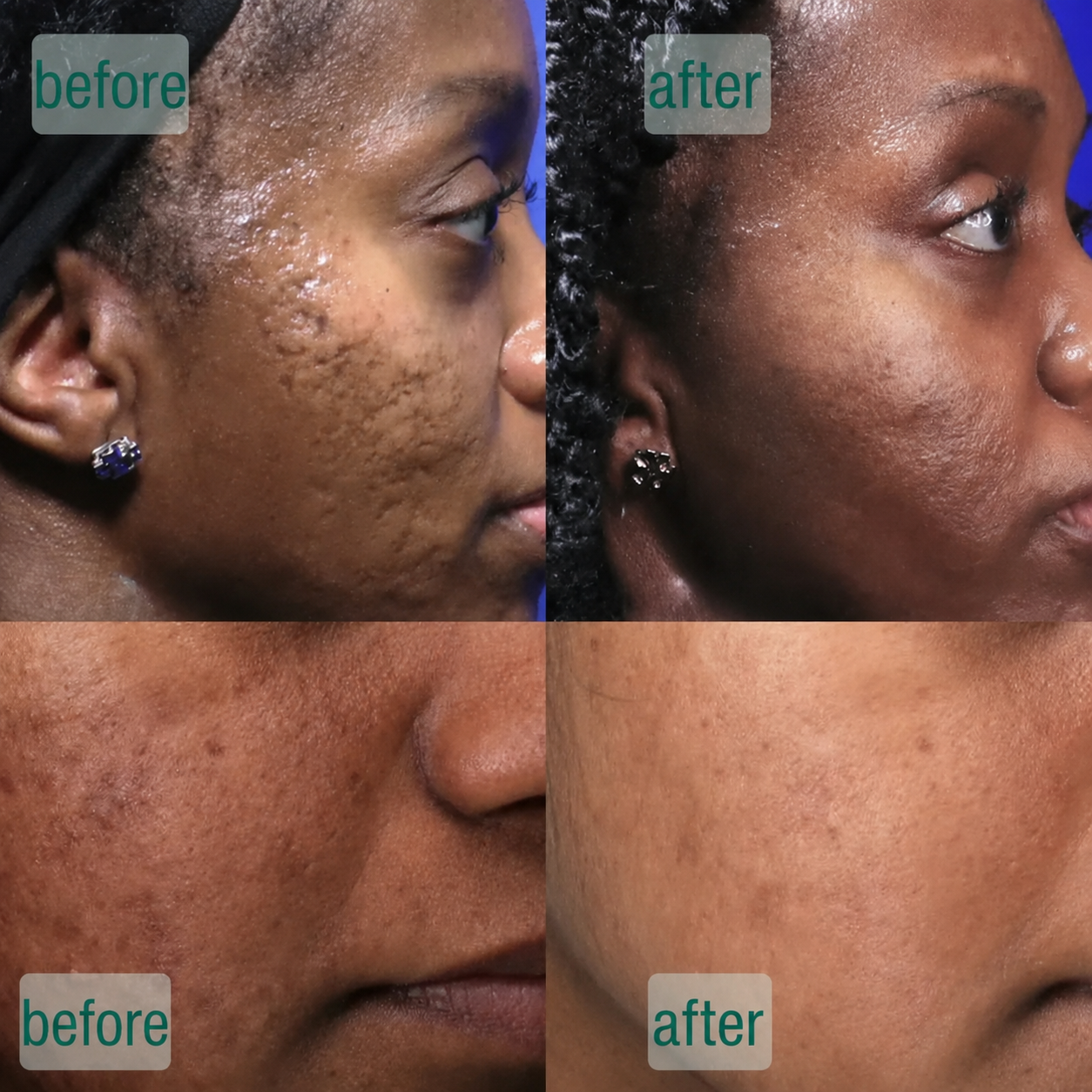 Microcrystal™ Serum PM Duo