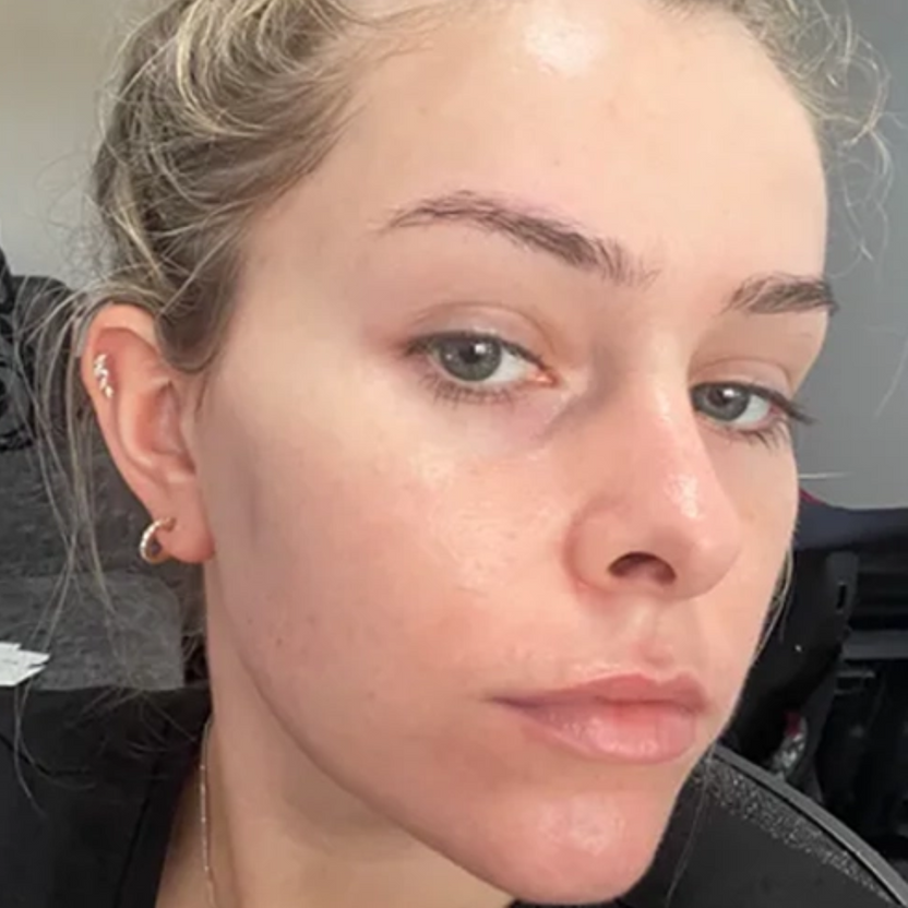 acne_cream_6.png