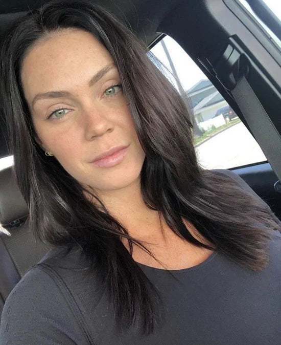 Customer skincare result photo