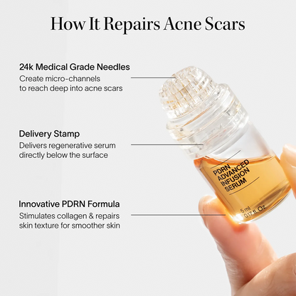 PDRN Advanced Infusion Treatment