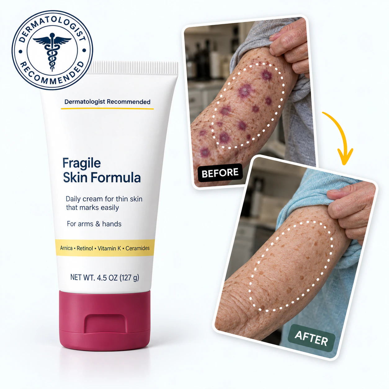  vibeourplus  Fragile Skin Formula with before-and-after forearm imagery