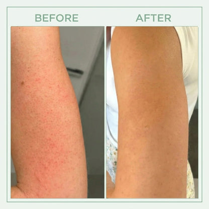 Vibeourplus™ Bright Peel Spray