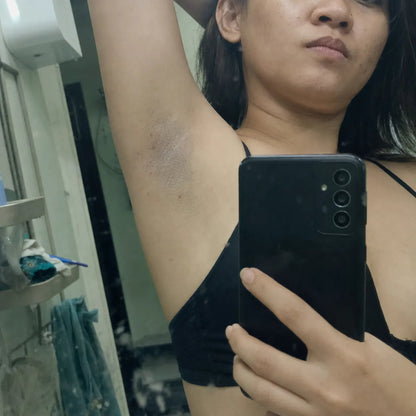 Underarm Brightening Cream
