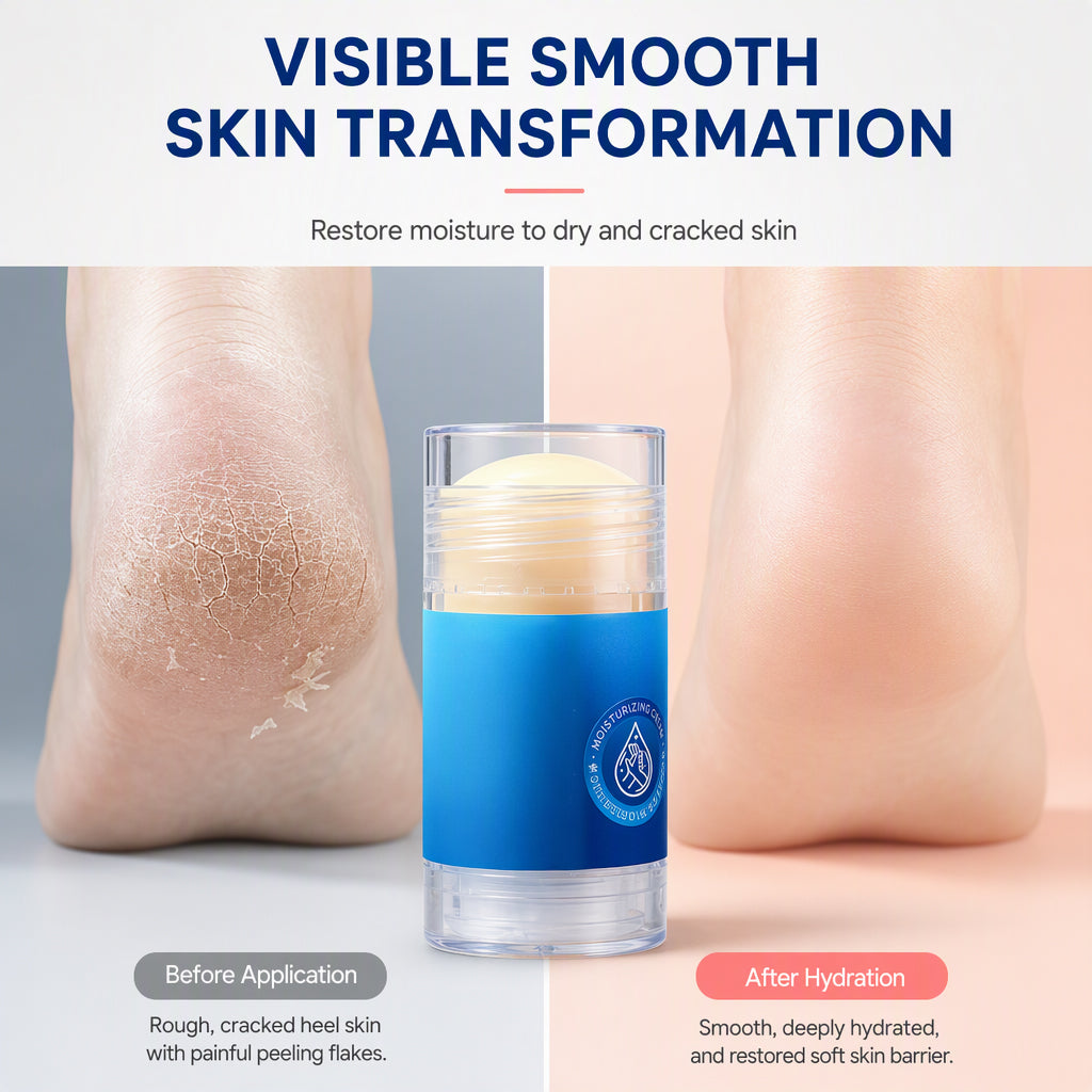 Illustrative comparison of dry and moisturized heel appearance