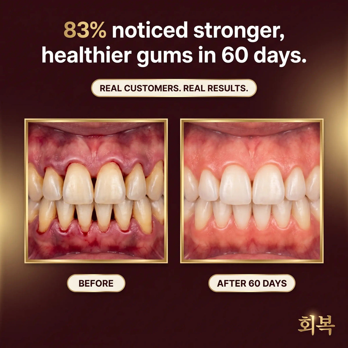 Gum Regrowth Armor