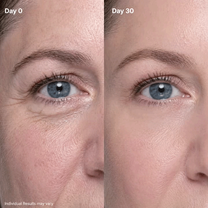 P7 Eye Renewal Crème