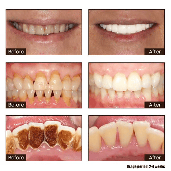 New 7-Pro Intensive Toothpaste | Upgraded Purple Formula with 7 Probiotics | Deep Enamel Repair & Long-Lasting Freshness#dealsforyoudays