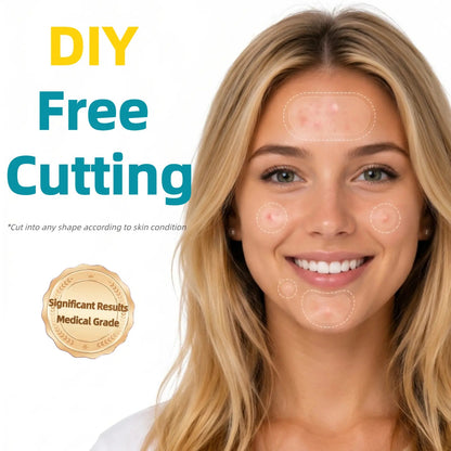 Hydrocolloid Acne Patch Roll – Cut to Any Size, 2 in × 16 ft