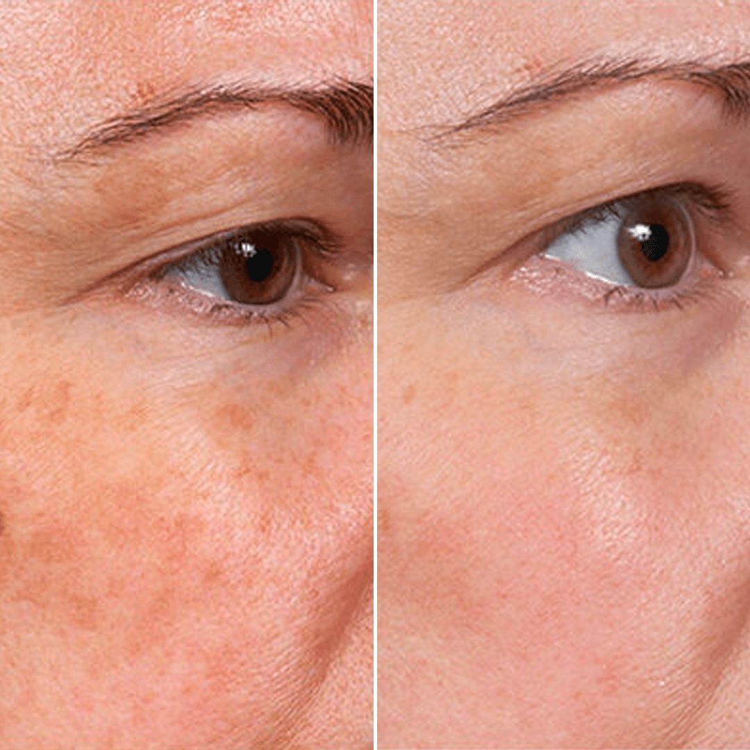 vibeourplus Face Serum