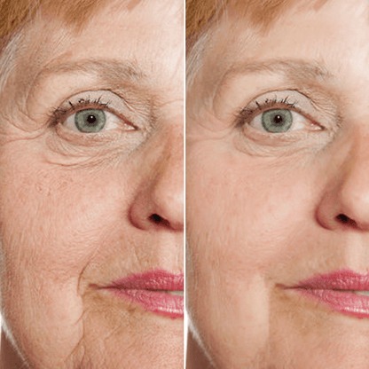 vibeourplus Face Serum