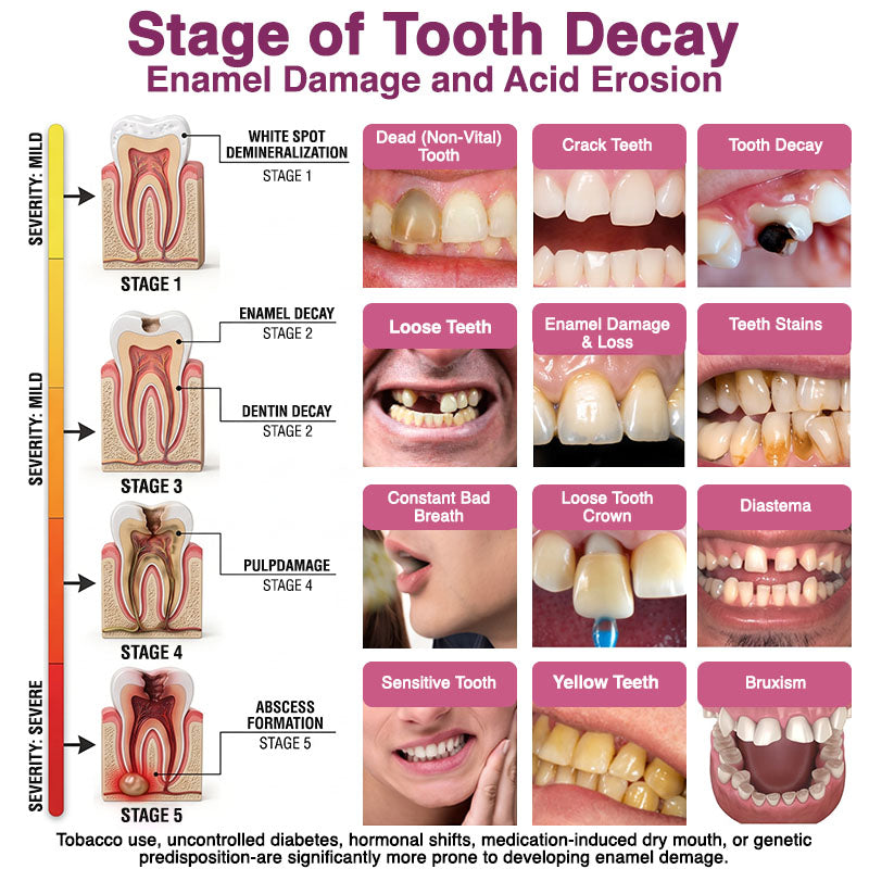 DenPerm Cavity-Repair Natural Enamel Filling Gel