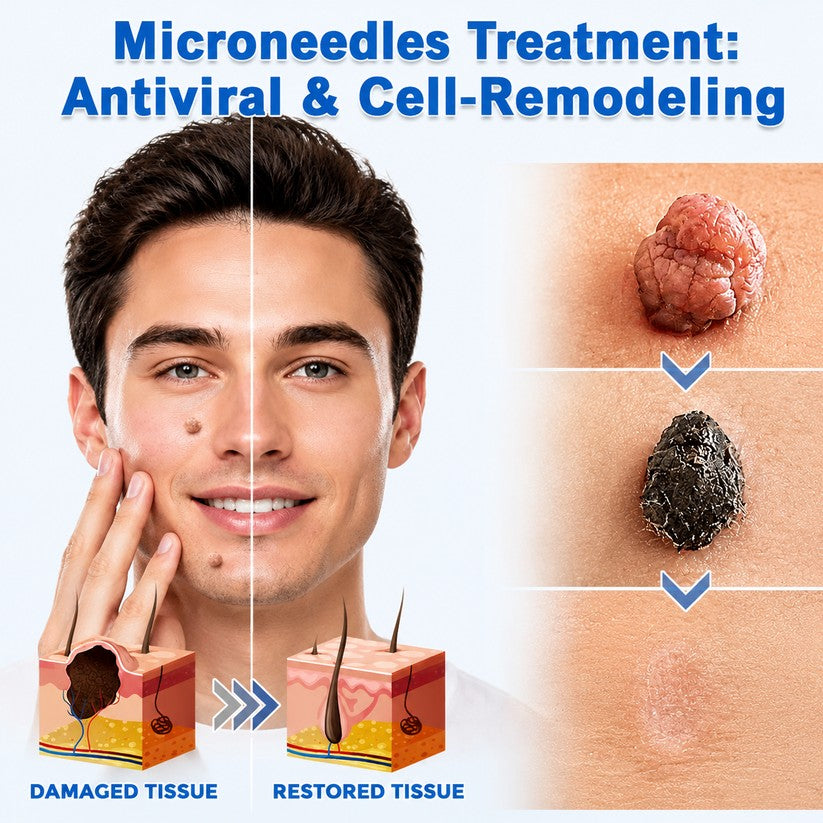 tryskintle® 2-in-1 Microneedle & Hydrocolloid Patch 🌿 Invisible Face & Body Patches for Raised Moles, Acne, Flat Warts & Skin Tags - Helps Improve the Appearance of Wrinkles, Scars & Blemishes