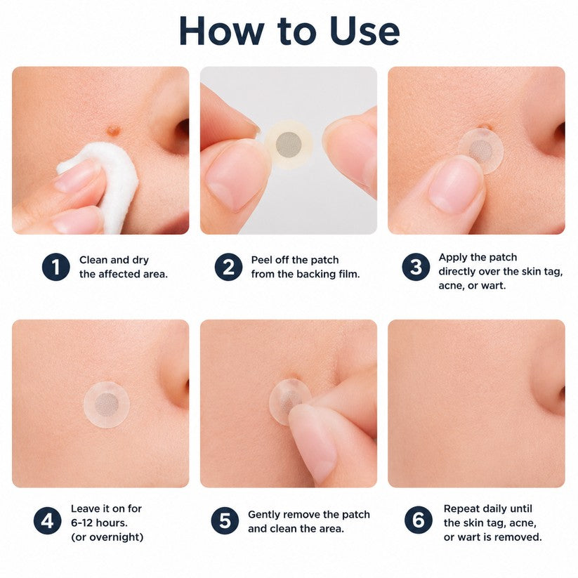 tryskintle® 2-in-1 Microneedle & Hydrocolloid Patch 🌿 Invisible Face & Body Patches for Raised Moles, Acne, Flat Warts & Skin Tags - Helps Improve the Appearance of Wrinkles, Scars & Blemishes
