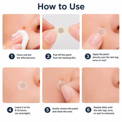 tryskintle® 2-in-1 Microneedle & Hydrocolloid Patch 🌿 Invisible Face & Body Patches for Raised Moles, Acne, Flat Warts & Skin Tags - Helps Improve the Appearance of Wrinkles, Scars & Blemishes