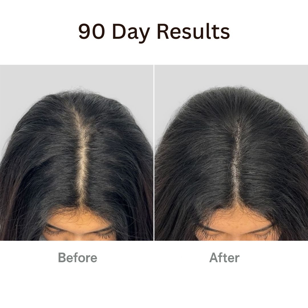 Vibeourplus™ The Natural 4in1 Hair Restoring Brush
