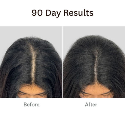 Vibeourplus™ The Natural 4in1 Hair Restoring Brush
