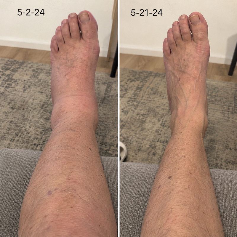 using Vibeourplus less than 8 weeks